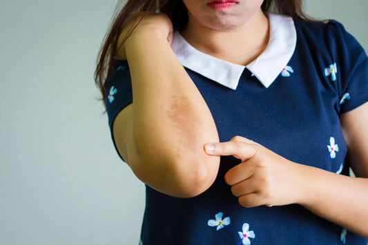 Alergii si piele atopică cum reduci riscul prin detergenți hipoalergenici